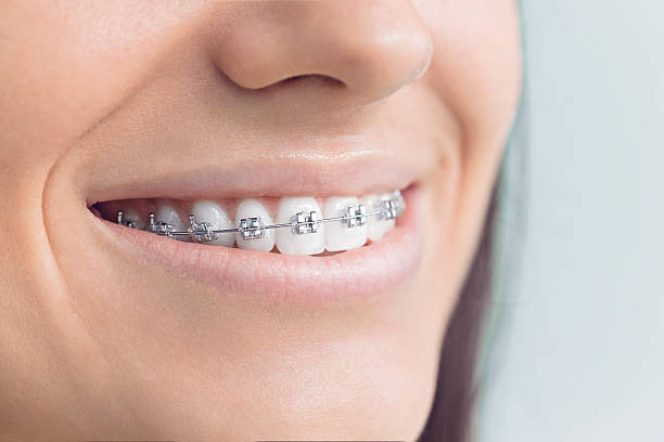 Best Wisdom Tooth Removal  in Wagoner, OK